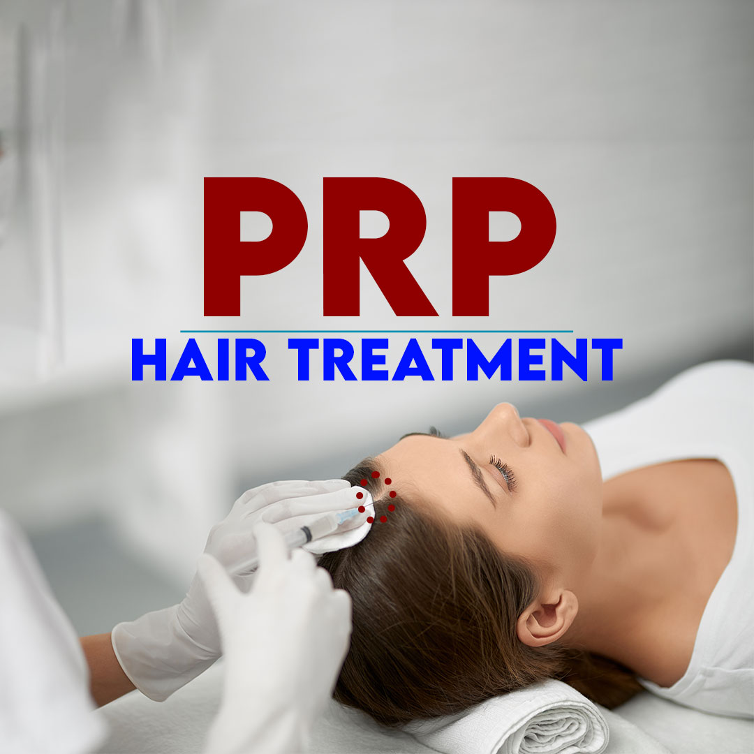 PRP HAIR TREATMENT