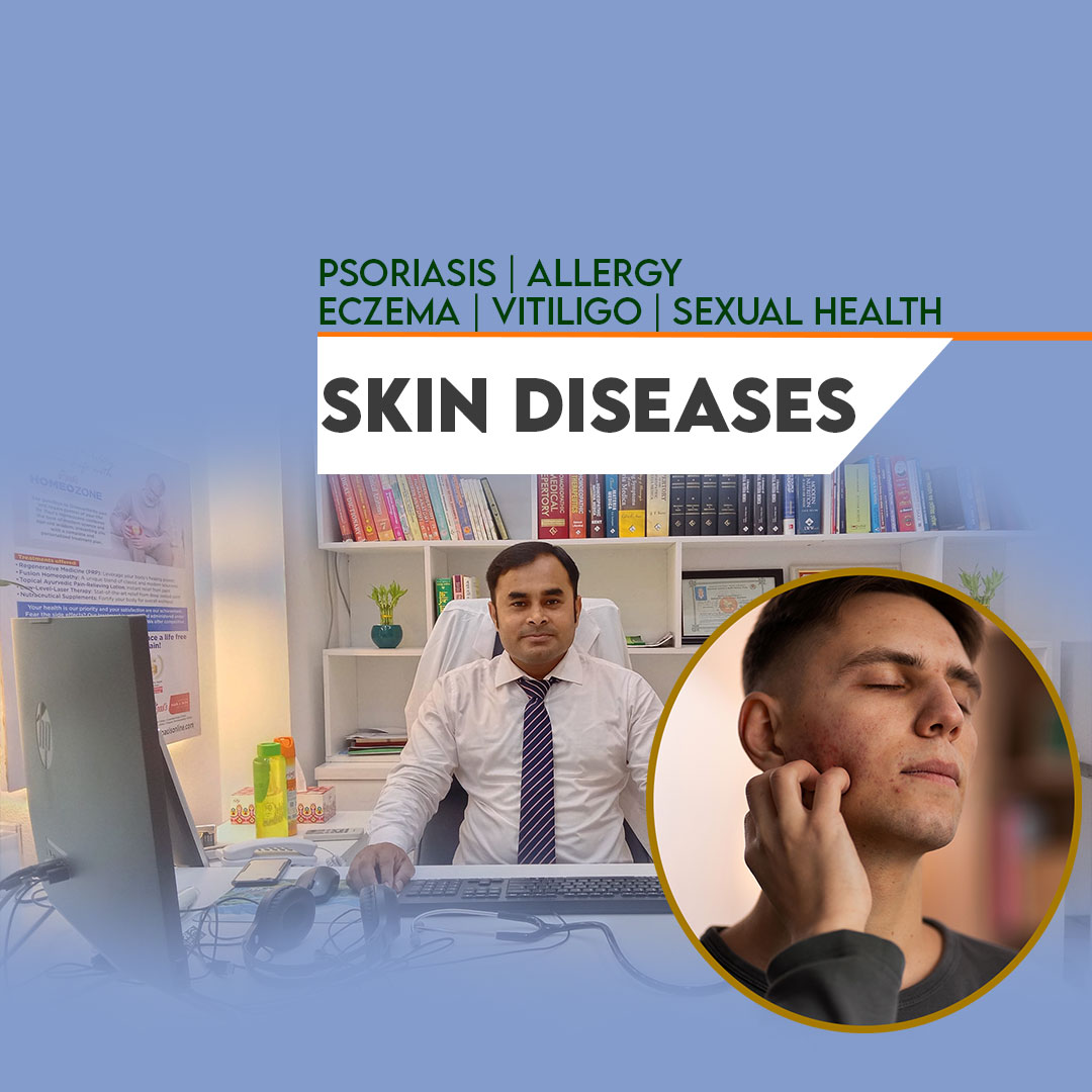 skin diseases treatment