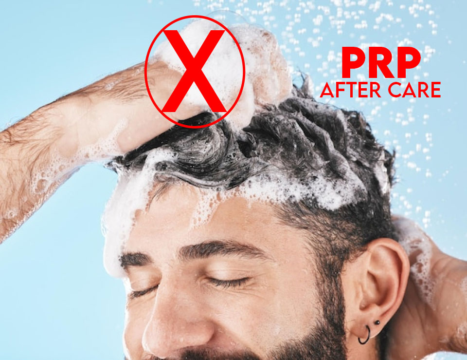 PRP aftercare