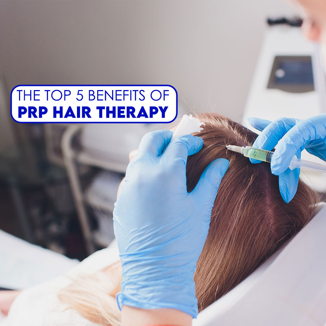 The Top 5 Benefits of PRP Hair Therapy